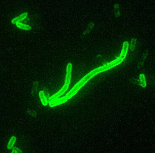 La bacteria Yersinia pestis es responsable de diferentes variedades de peste y cuenta con centenares de millones de vidas humanas a sus espaldas, sin contar otras especies vulnerables